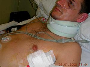  � La guàrdia civil i la versió oficial mantenen que les dues costelles fracturades d'Igor Portu van produir-se en el moment de la detenció, quan el jove va intentar fugir i els agents es van tirar a sobre seu per interceptar-lo.